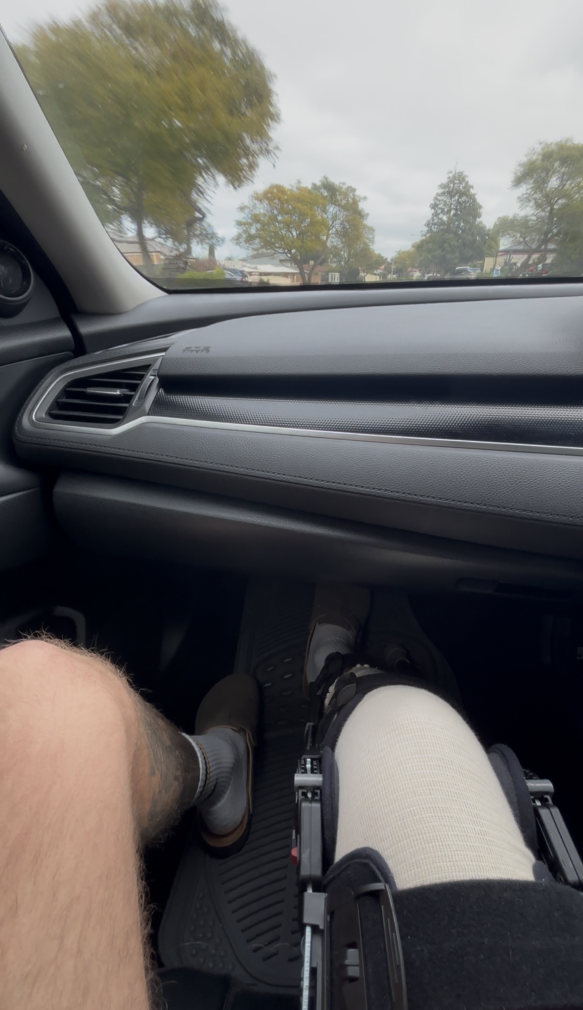 Knee Surgery Recovery 