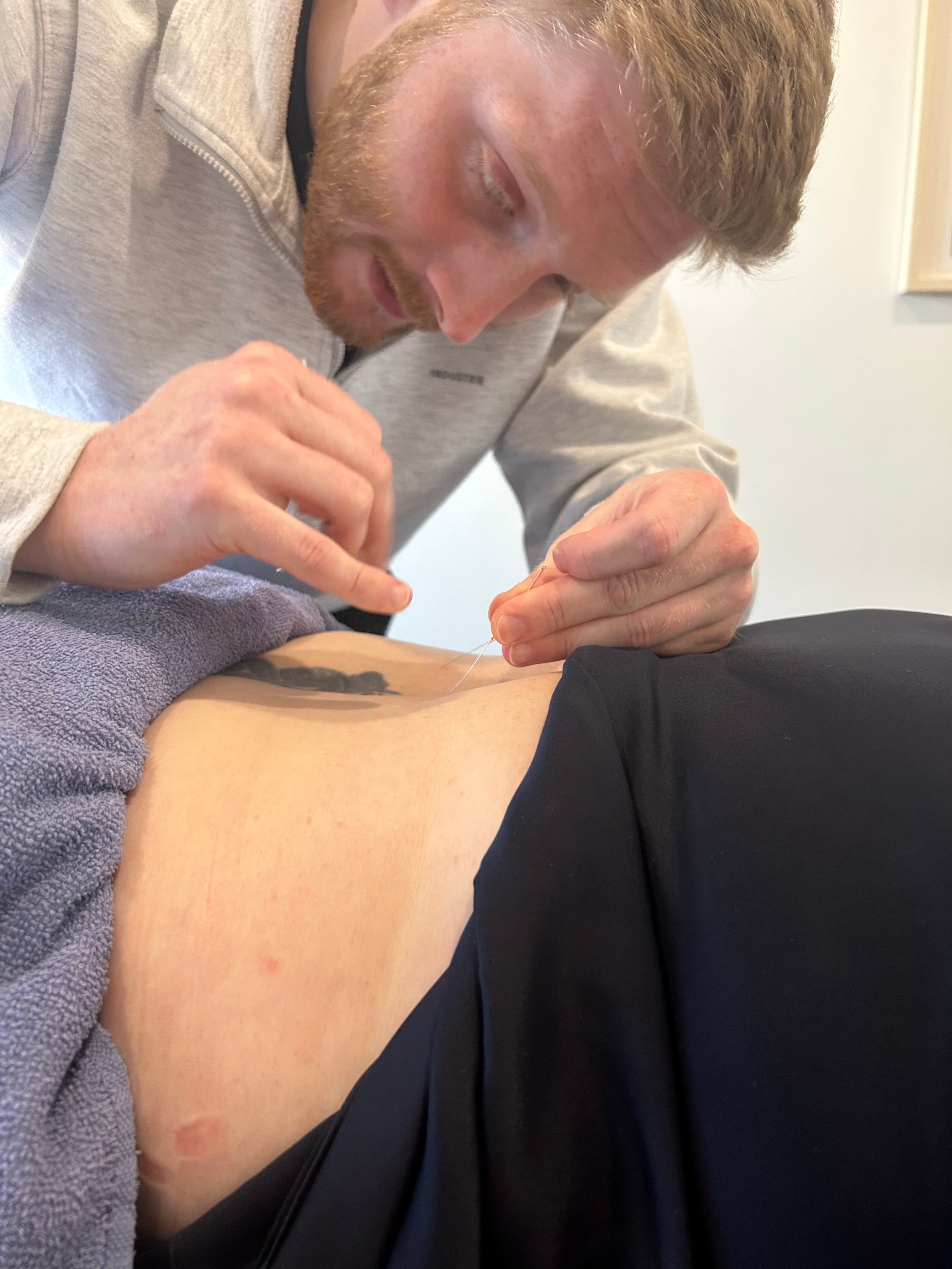 apex physio 2